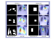 Researchers develop COVID-19 diagnosis technique using X-ray images Researchers develop COVID-19 diagnosis technique using X-ray images