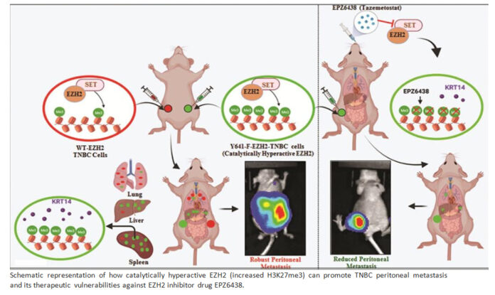 Researchers find novel way to target Triple-Negative Breast Cancer