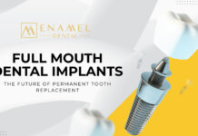 Why Full Mouth Dental Implants Are the Future of Permanent Tooth Replacement